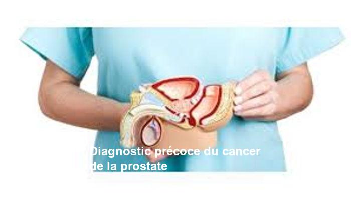 diagnostic pr coce du cancer de la prostate GFU7iEeB.jpg